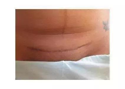 世上最丑的“微笑”，你也曾拥有过？ta令人痛苦、自卑，但伟大！