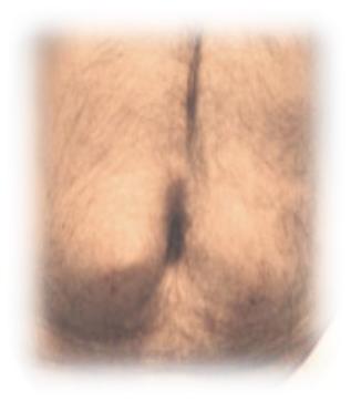 为什么先注射胰岛素再注射葡萄糖,胰岛素注射笔使用方法及注射部位