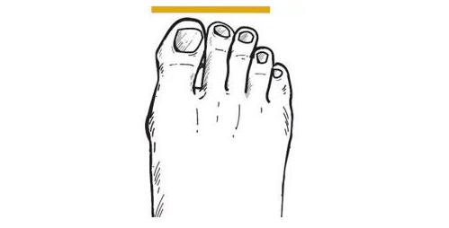 脚趾磨起水泡一直不消,脚趾总磨起泡怎么办