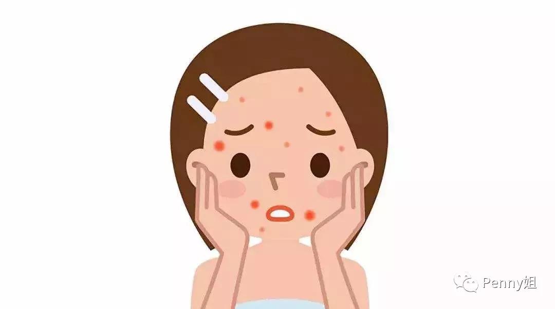 如何有效去除痘印痘痘,治疗痘印痘疤费用