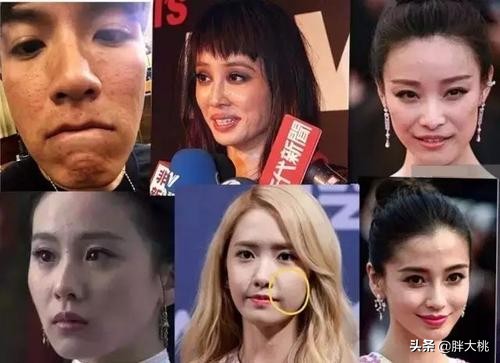 去闭口的最佳方法推荐,大家有没有去闭口的小妙招