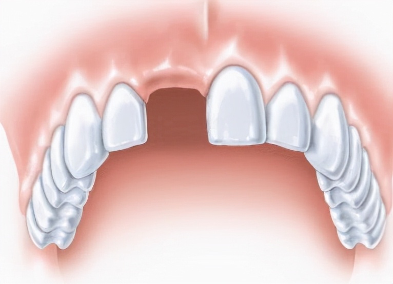 人的牙齿多代表什么,人的牙齿有哪些
