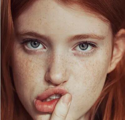 脸上有雀斑7秒钟搞定,雀斑一扫而光的原理