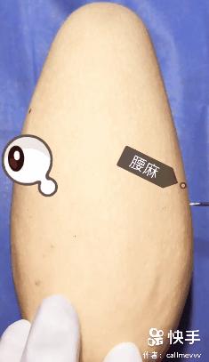 香蕉割包皮，洋葱剖腹产？这是我见过最秀的医生