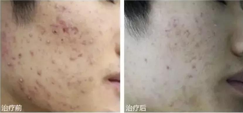 送给爱美的你！5.25护肤日，苏州科技城医院皮肤美容优惠享不停