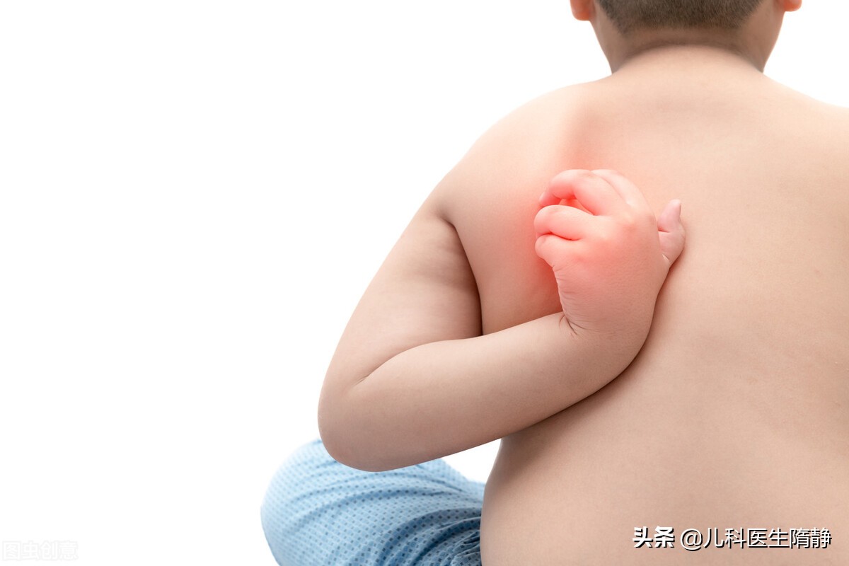 周身起风团的原因,春夏季皮肤一热就发痒不红不肿