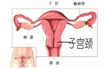 宫颈糜烂是导致不孕吗,宫颈糜烂不孕的原因
