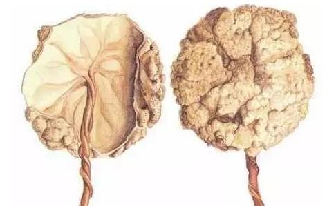 宝宝顺产出生的过程,剖腹产的小孩比顺产的小孩胆小吗