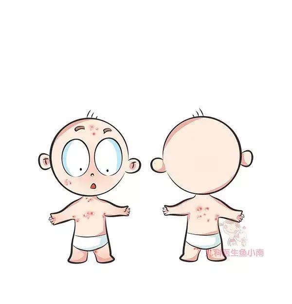 热疹皮疹湿疹有什么区别,湿疹和荨麻疹有什么区别怎样判断