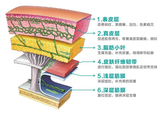线雕和玻尿酸筋膜提升有什么区别,玻尿酸线雕是什么样子