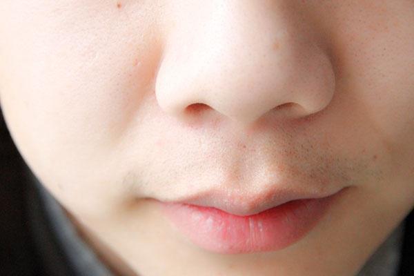 鼻子周围有白色凸起小包,鼻子上有白点挤不出来像小米粒