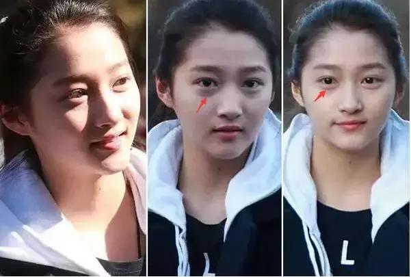 眼袋怎么消除简单方法男生,黑眼袋怎么消除最快方法男士