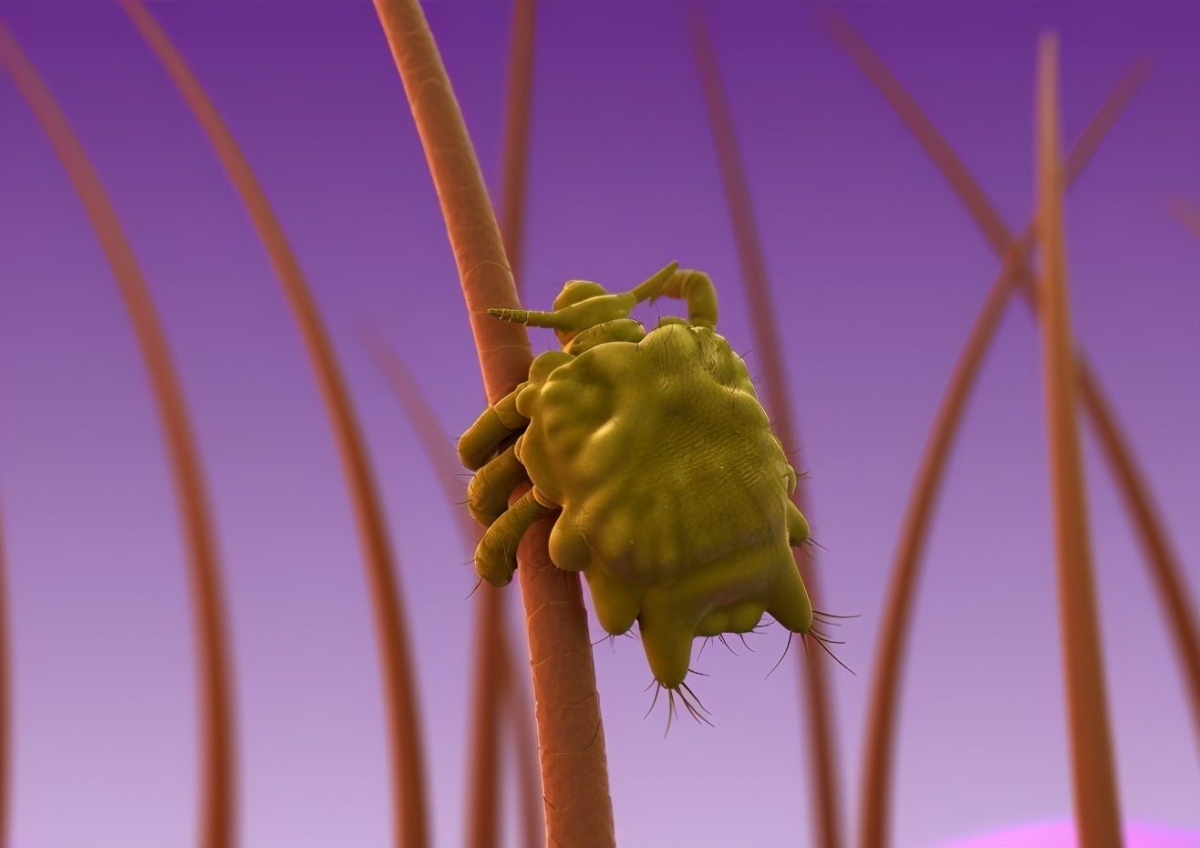 医生检查阴虱的镊子和刀片,男子臀部长出红疹瘙痒