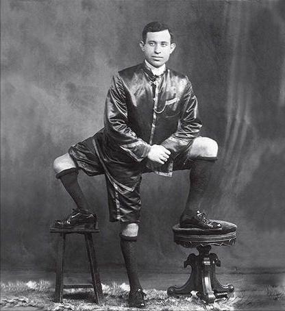 他是美国马戏圈里的“国王”，拥有三条腿，结过两次婚，活了77岁