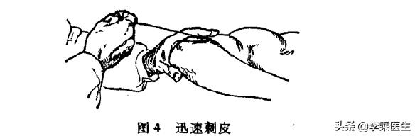 金针王乐亭全部视频,金针王乐亭徒弟