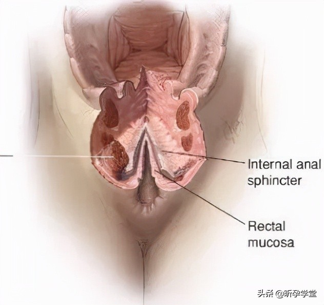 医生不建议侧切,医生不给我缝合伤口