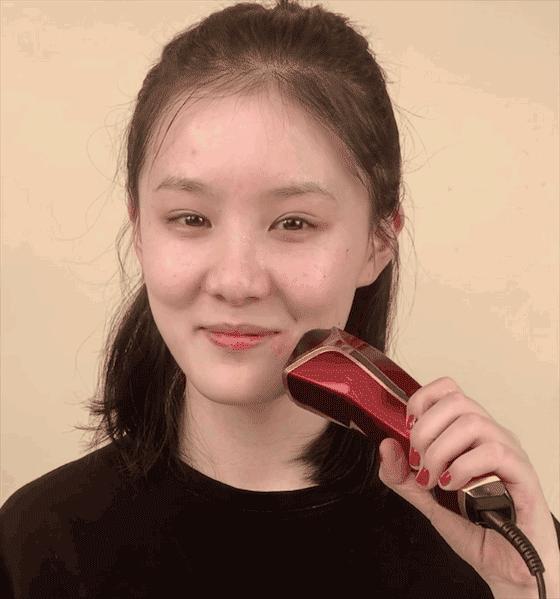 做了微整之后的感悟,微整经验