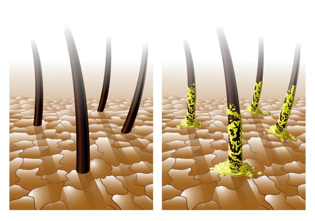天天洗头还是很油腻怎么解决,天天洗头出现出油严重现象怎么办