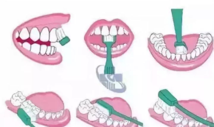 保护牙要用什么牙刷,牙刷保护牙的五大误区