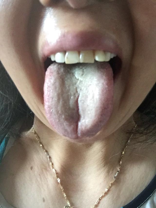 肾虚寒湿证的治法,肾虚湿热症用什么中药调理