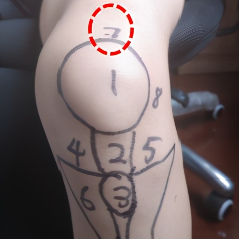 膝盖痛12种疼痛对照表图解,不同部位膝盖疼痛的原因