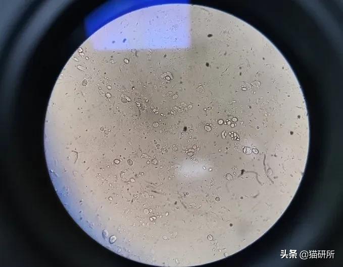 显微镜下的猫屎，竟然和这么多食物都撞脸？