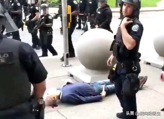 后脑勺着地很危险的,为什么后脑勺着地危害大