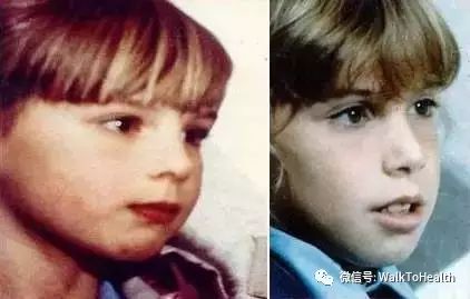 别让口呼吸毁掉你的颜值,脸毁了怎么补救