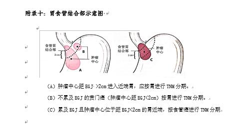 我国胃癌新发人数,2020年我国胃癌新发病例数达多少
