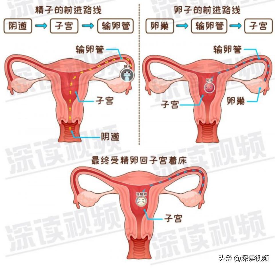宫外孕还来大姨妈怎么回事,陈旧性宫外孕是怎么回事