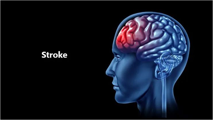 干细胞治疗脑中风后遗症最新消息,干细胞治疗脑中风多长时间有效啊