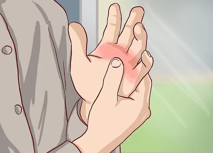 手骨折反复疼痛怎么办,手痛了一个月是骨折吗