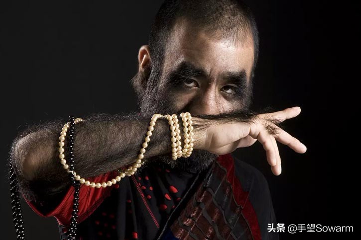 全世界体毛最多的人，是如何在歧视中逆袭为实力派歌手的？