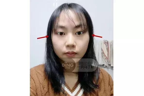 颅顶太低如何自救,颅顶低怎么自救