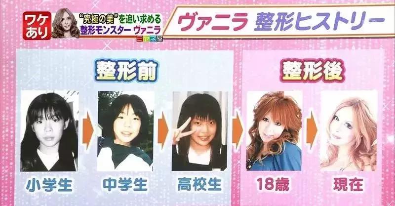 日本妹子花1286万元整容成芭比娃娃?!见识到了“可怕”……