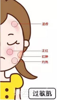 夏季常见皮肤问题该如何解决,春夏换季皮肤痒怎么办