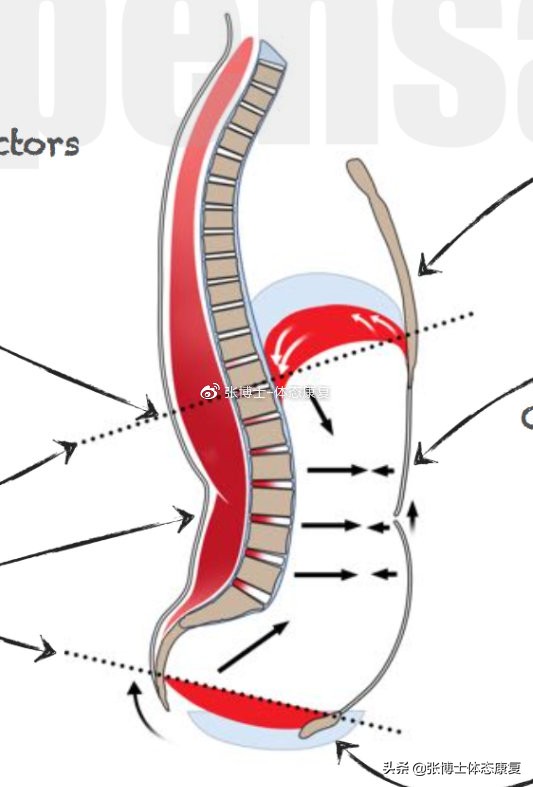 骨盆前倾造成的错位,单侧骨盆倾斜矫正方法