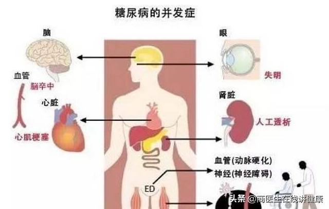 糖尿病伤着肾吃什么药最好,糖尿病损伤神经吃点什么药
