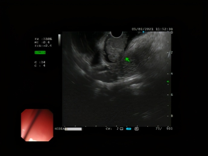 胃经常不舒服有时候还恶心,胃经常不舒服也不疼