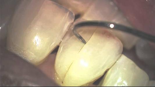 牙齿看起来不烂但是好痛,牙齿看着没问题可是疼怎么办