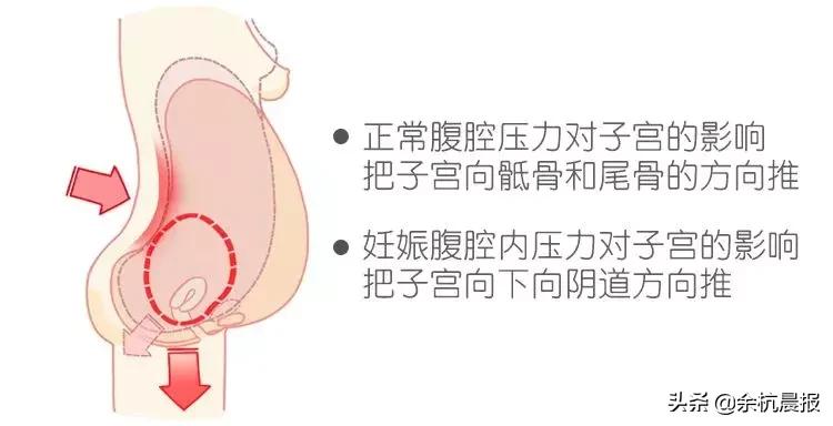 注意！近50%的余杭女性都被这个毛病折磨！这次带来一个好消息！