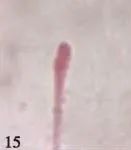 奇怪的知识增加了手指长度,奇怪的知识增加了图片大全