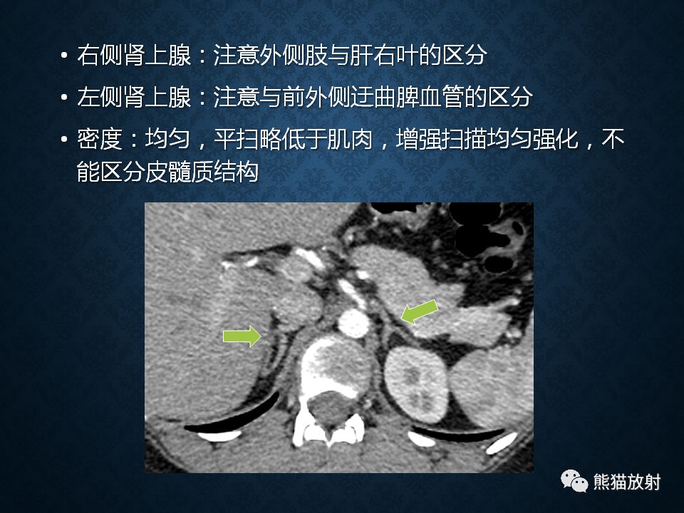 纵隔和肾上腺恶性肿瘤,纵隔性肿瘤位置图
