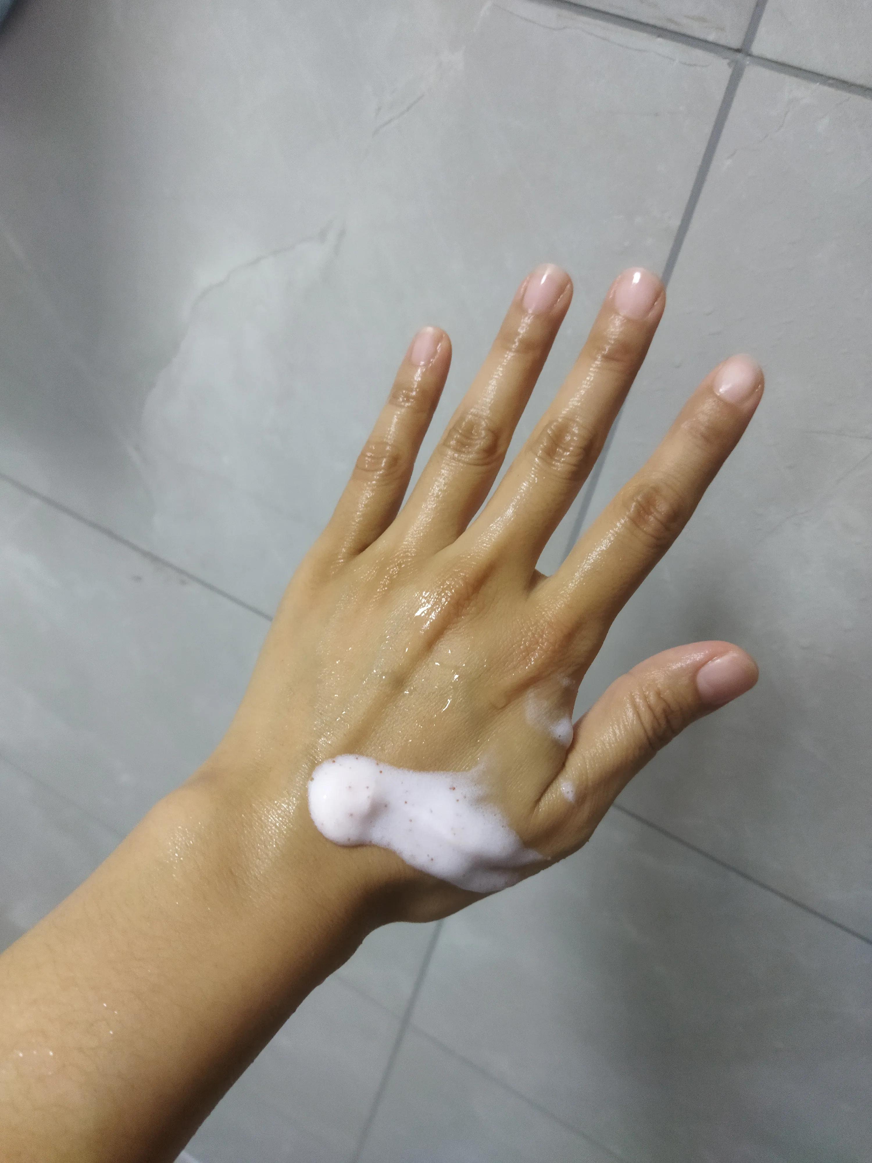 肘关节发黑变白要多长时间,手肘膝盖发黑怎么治