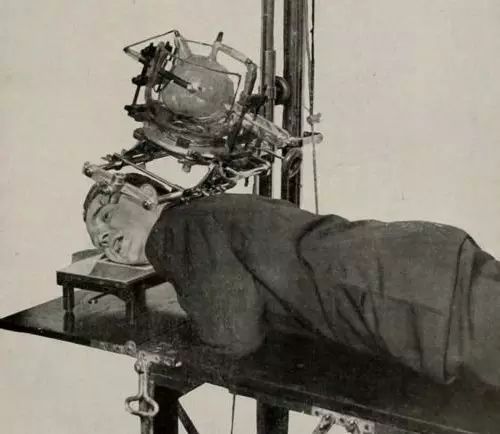 用X光脱毛、试鞋、选美，那些玩X光的勇士最后都怎样了？