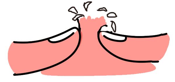 如何有效祛除痘印简单方法,怎么有效简单的祛除痘印的方法