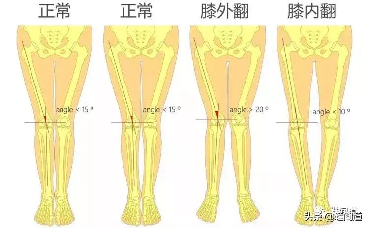 足弓对人体的影响｜脚型对鞋子的要求（附：选购建议）