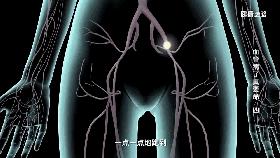 腿肿不治后果,腿肿是肺不好吗