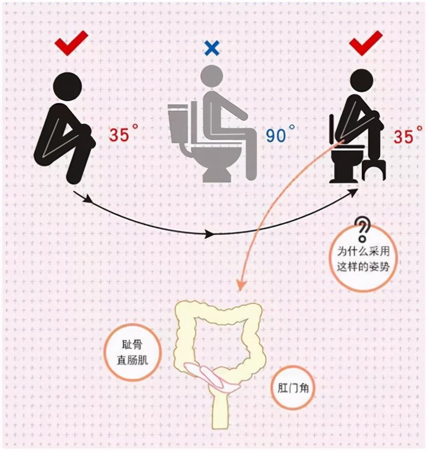 天冷了为什么容易便秘怎样改善,便秘是怎么回事呢
