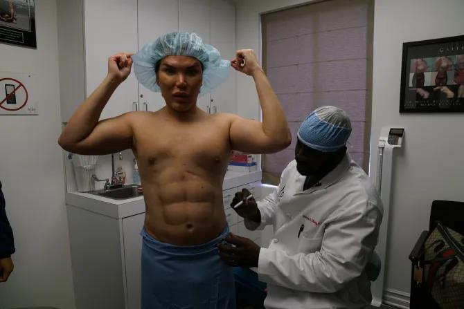 “真人肯尼”痴迷整容多年后，最终将自己整成了女人